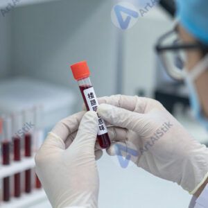 Лаборант в перчатках держит пробирки с кровью.