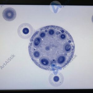 Микроскопический снимок клетки на мониторе